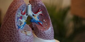 Medical model of lungs